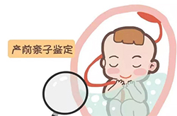 在[云南]怀孕期间需要怎么做亲子鉴定，云南产前亲子鉴定大概多少钱